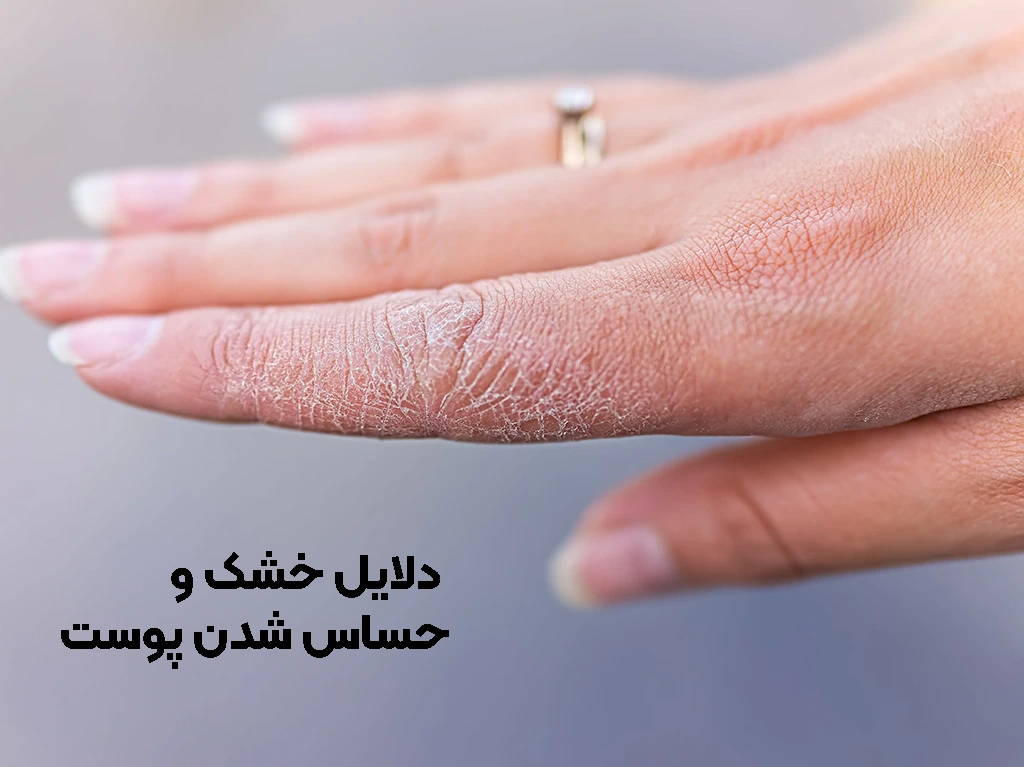 چرا پوست خشک و حساس می شود؟