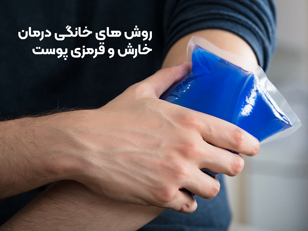 درمان های خانگی برای خارش و قرمزی پوست