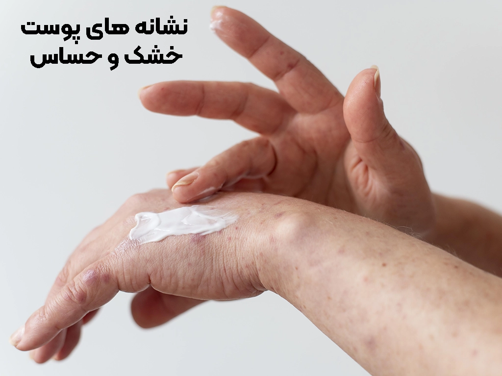 علائم پوست خشک و حساس