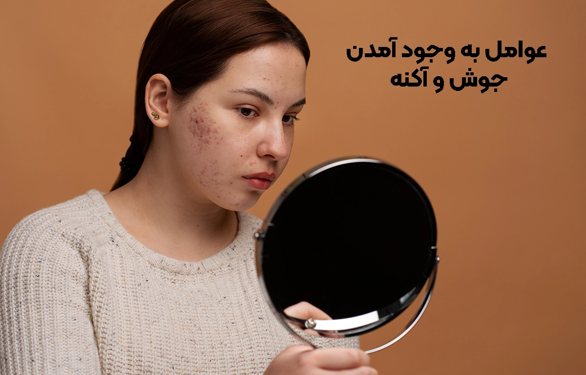 عوامل ایجاد جوش و آکنه