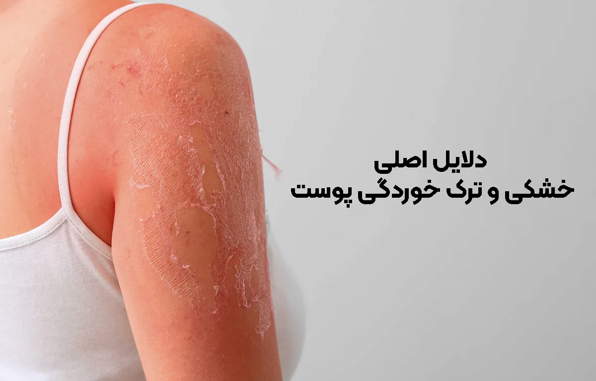 دلایل خشکی پوست