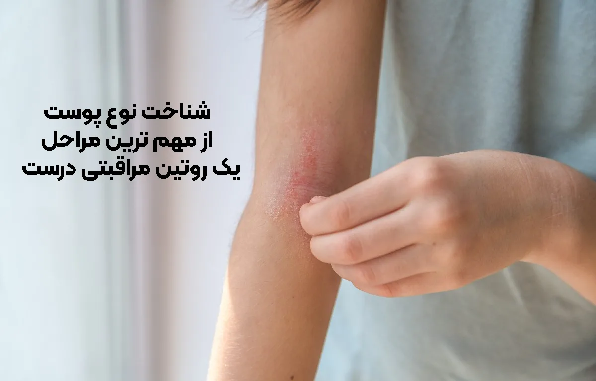 شناخت نوع پوست، یکی از مهم ‌ترین مراحل برای شروع یک روتین مراقبتی درست