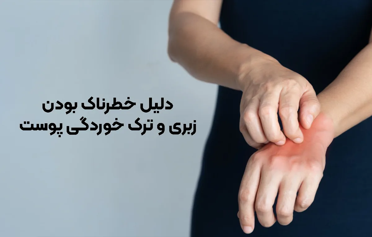 چرا زبری و خشکی پوست خطرناک است؟