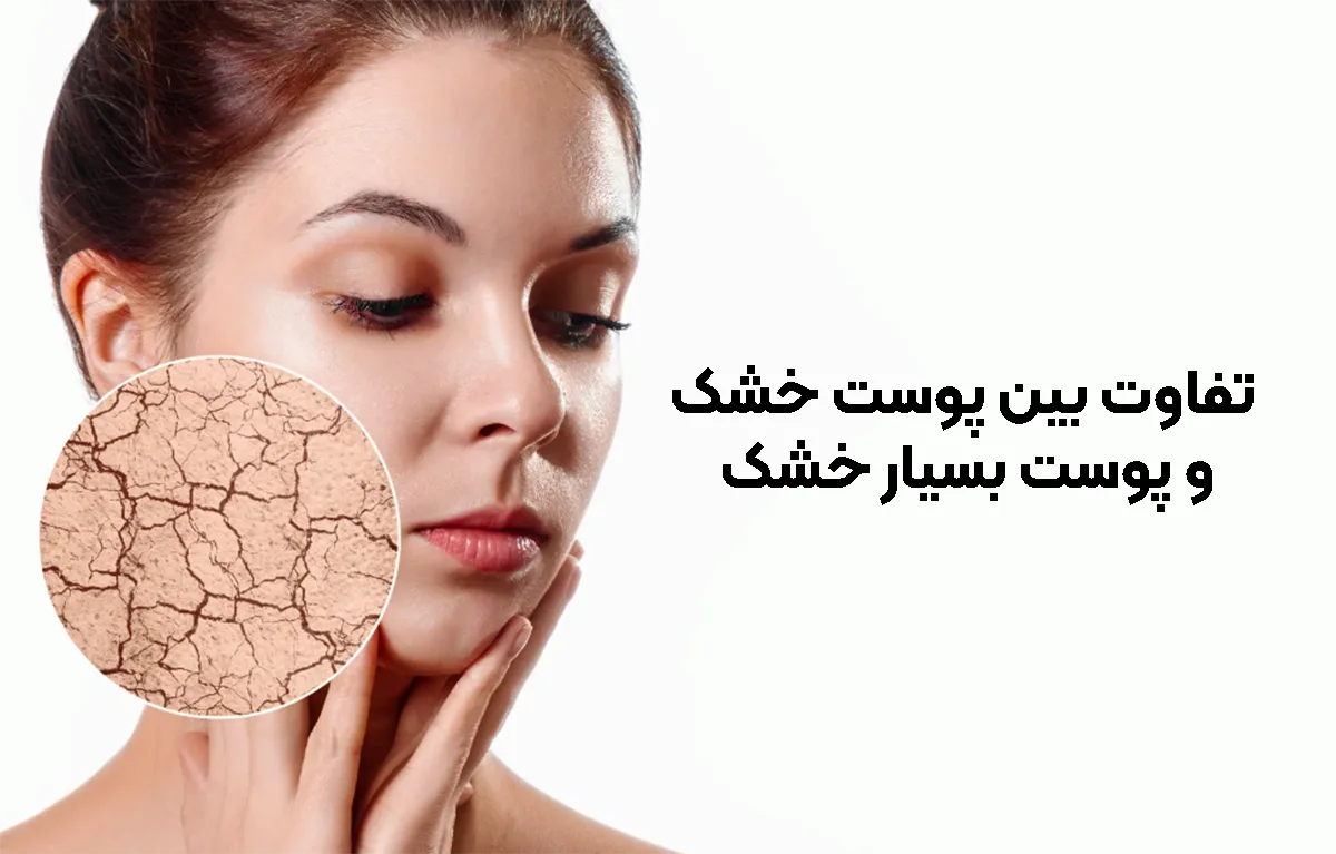 تفاوت های پوست خشک و بسیار خشک
