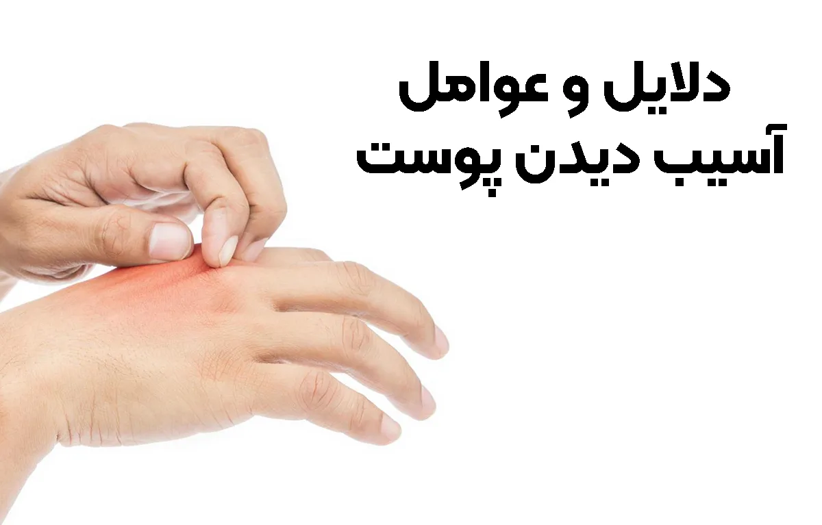 دلایل و عوامل آسیب دیدن پوست