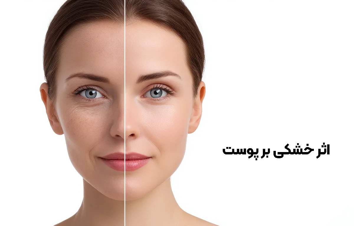 اثر خشکی بر پوست