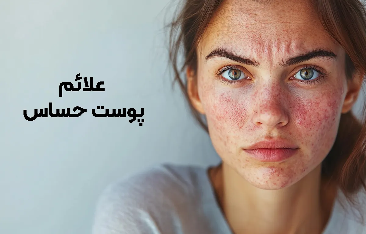 علائم پوست حساس