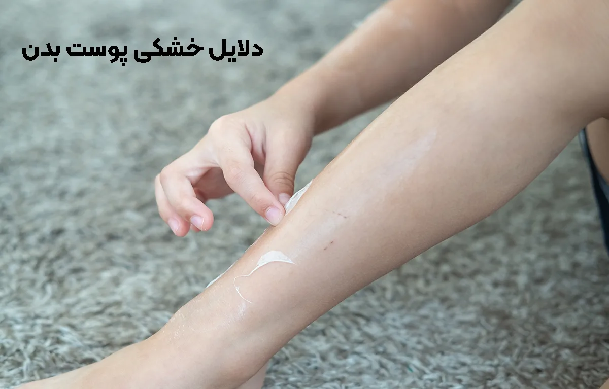 دلایل خشکی پوست بدن