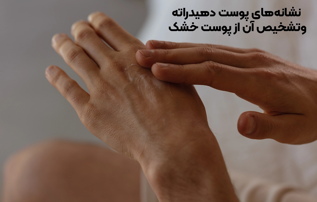 نشانه‌های پوست دهیدراته چیست و چگونه آن را از پوست خشک تشخیص دهیم؟