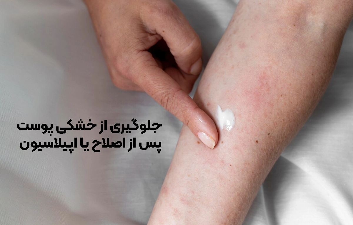 جلوگیری از خشکی پوست پس از اصلاح یا اپیلاسیون