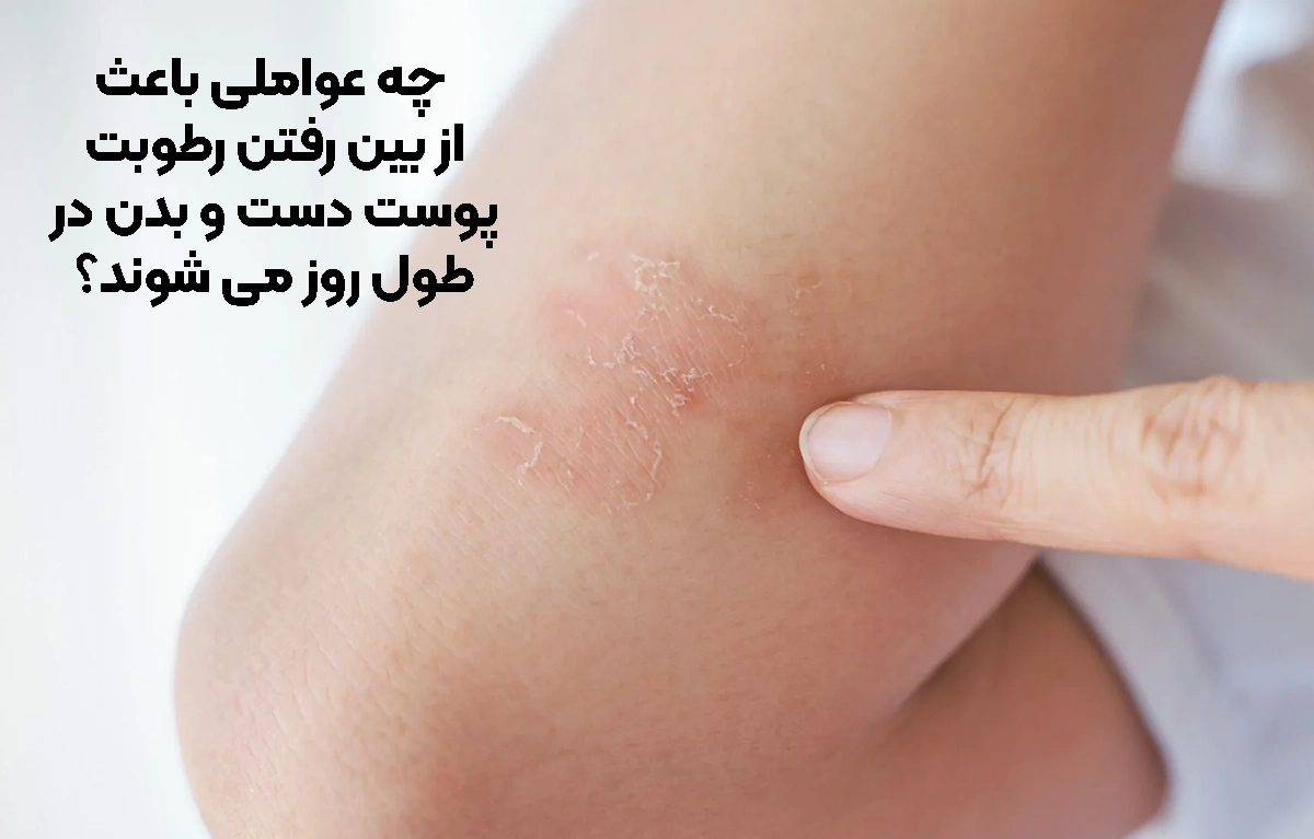 چه عواملی باعث از بین رفتن رطوبت پوست دست و بدن در طول روز می‌ شوند؟