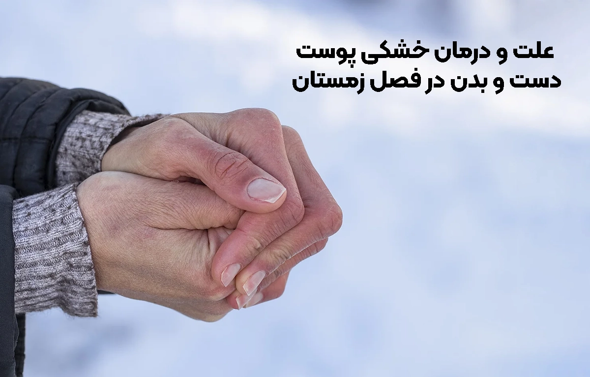 علت و درمان خشکی پوست دست و بدن در فصل زمستان