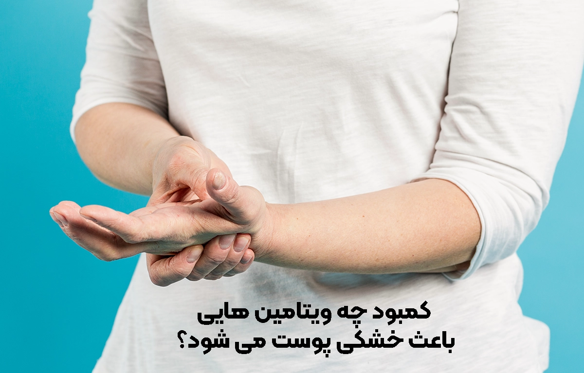کمبود چه ویتامینی باعث خشکی پوست دست و بدن می شود؟