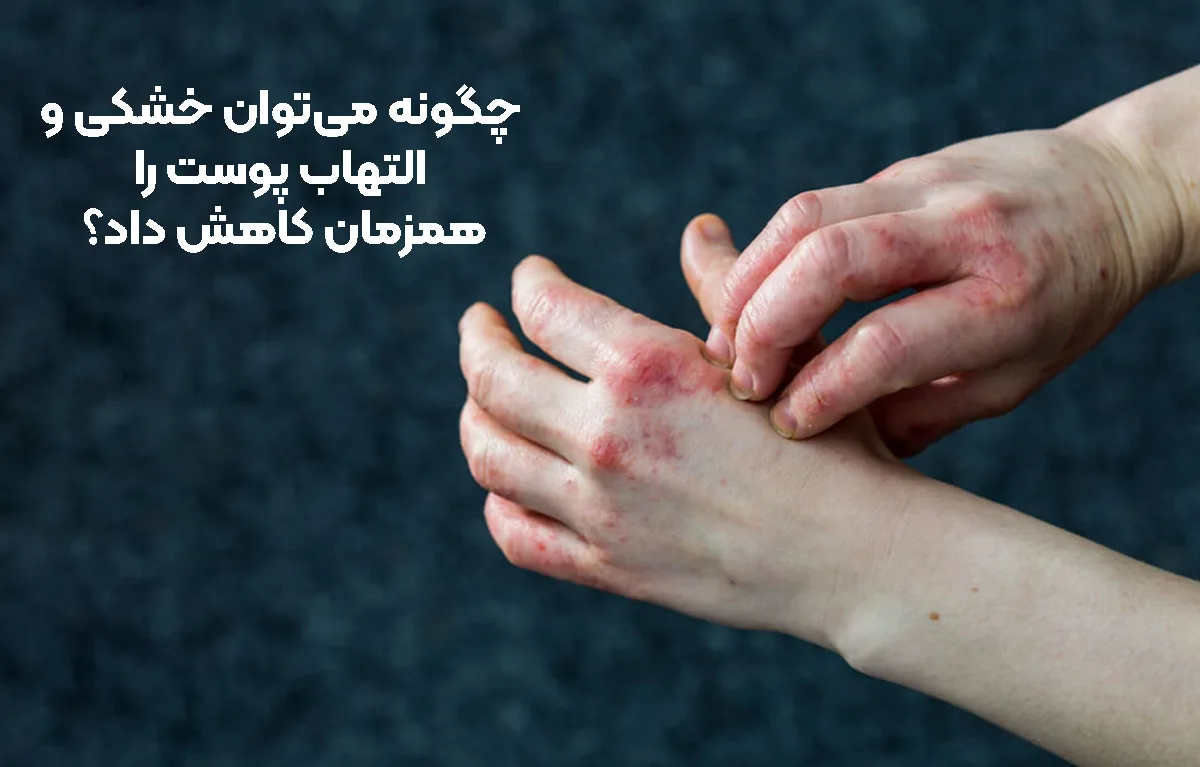 چگونه می‌توان خشکی و التهاب پوست را همزمان کاهش داد؟