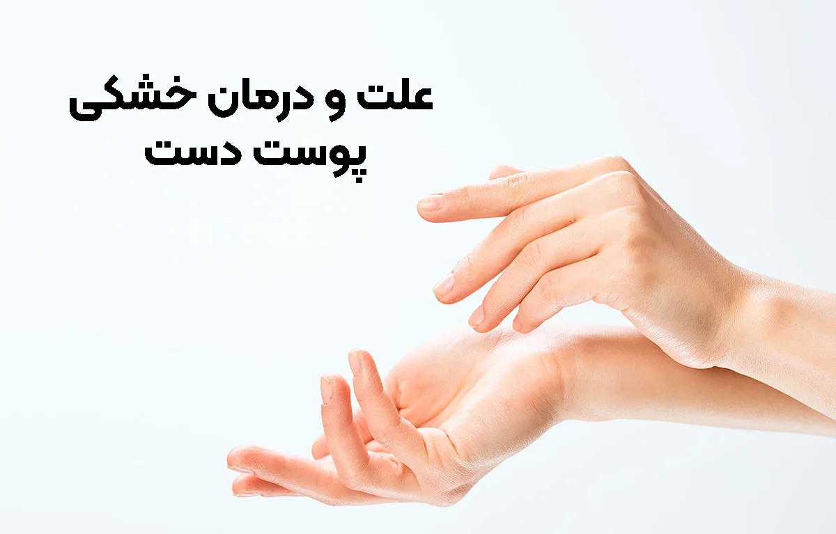 علت و درمان خشکی پوست دست