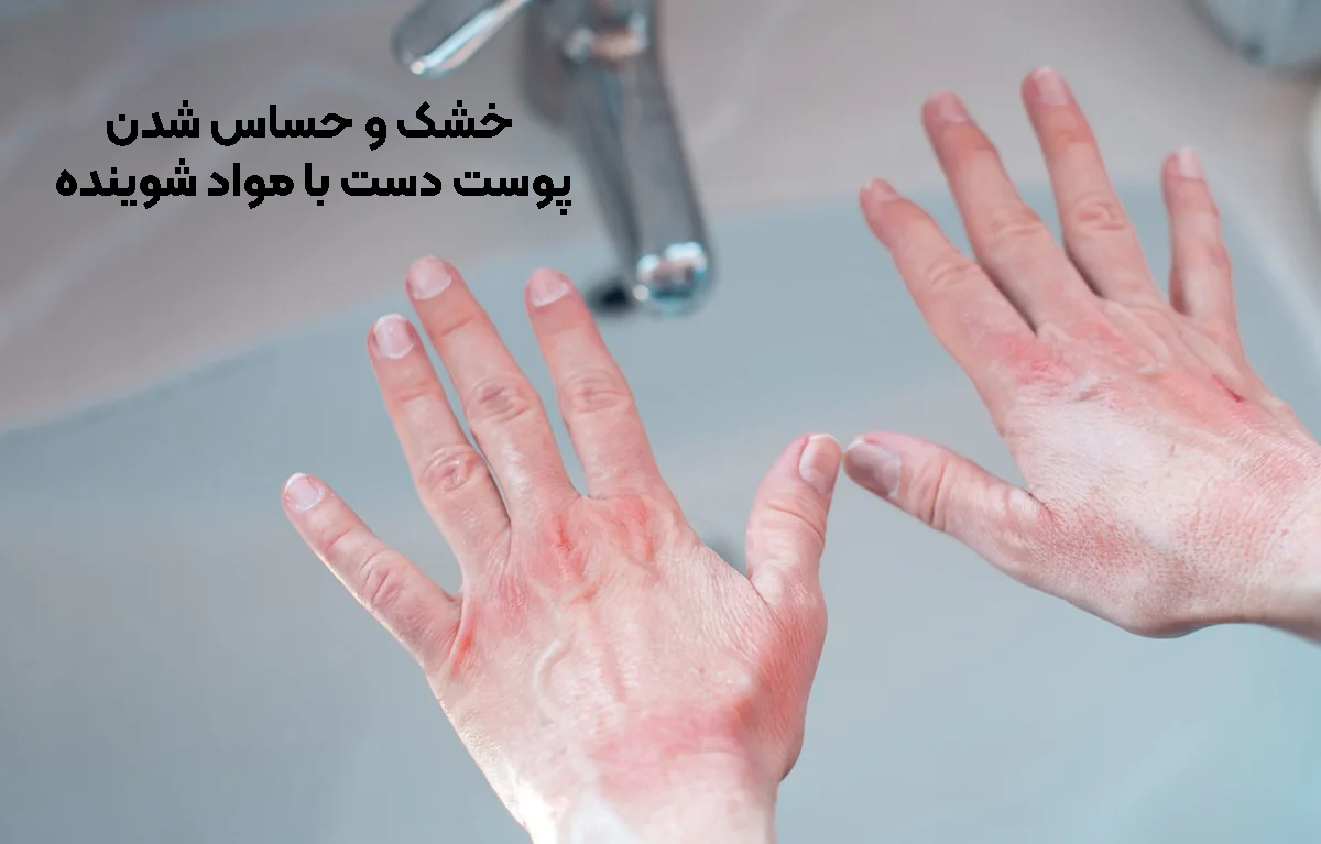 خشک و حساس شدن دست با مواد شوینده