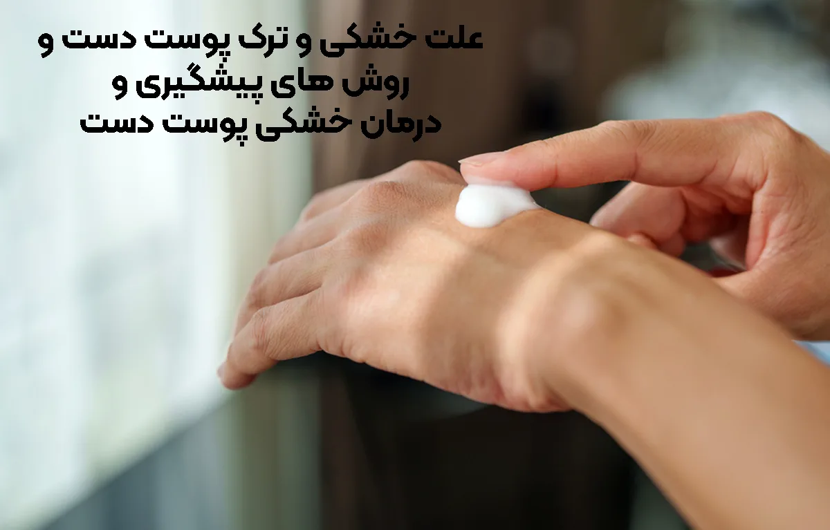 علت خشکی و ترک پوست دست + روش ‌های پیشگیری و درمان خشکی پوست دست