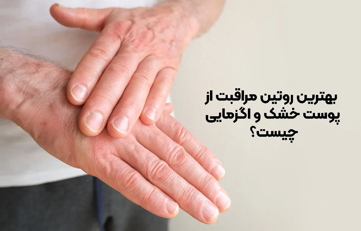 بهترین روتین مراقبت از پوست خشک و اگزمایی چیست؟