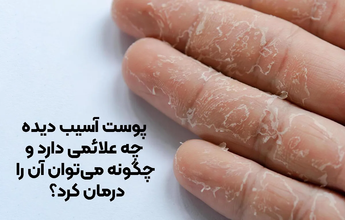 علائم و راه های درمان پوست آسیب دیده